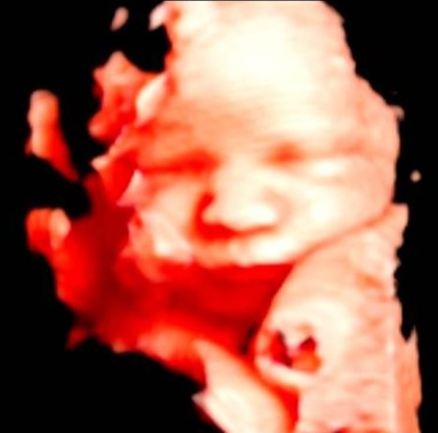 PHOTO-2025-05-29-13-28-12 3